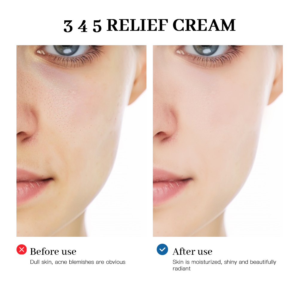 345 릴리프 크림 피부 문제에 대한 종합적인 솔루션  - Retinol Cream 리뷰 및 가격